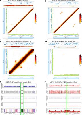 Linked-read based analysis of the medulloblastoma genome